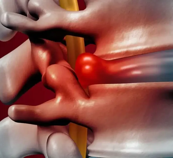 Misery Loves Company